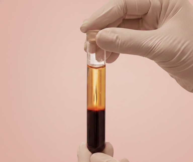 ovarian rejuvination prp